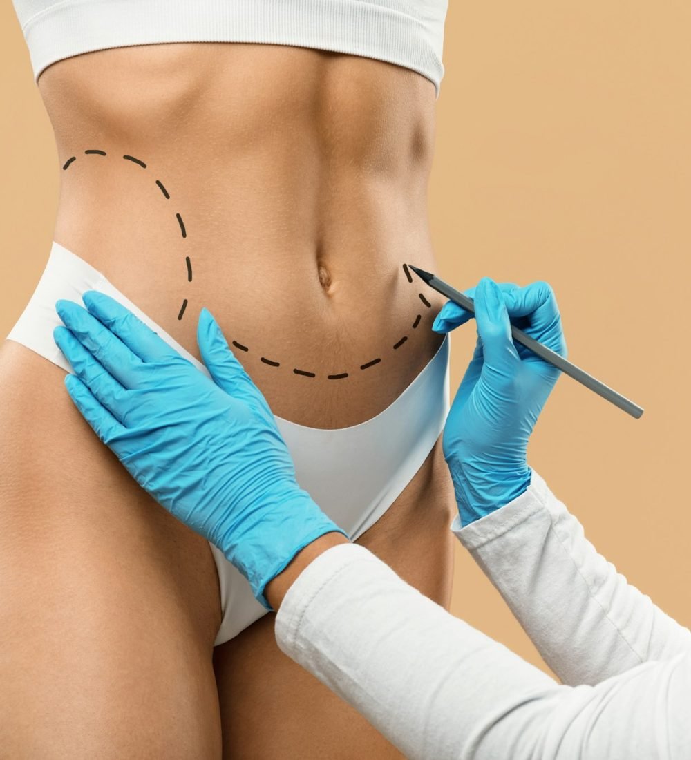 Doctor Drawing Dashed Line Marks On Female Body Before Plastic Surgery Operation